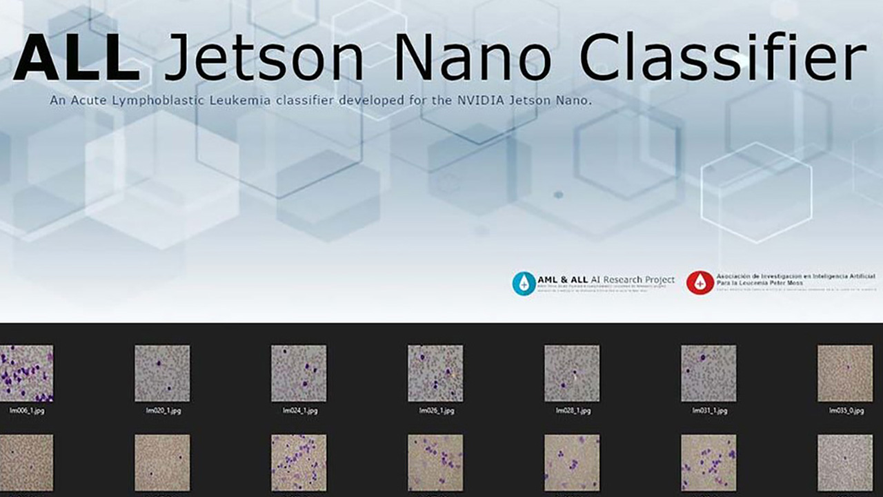 Adam Milton-Barker Detecting Acute Lymphoblastic Leukemia with NVIDIA Jetson Nano
