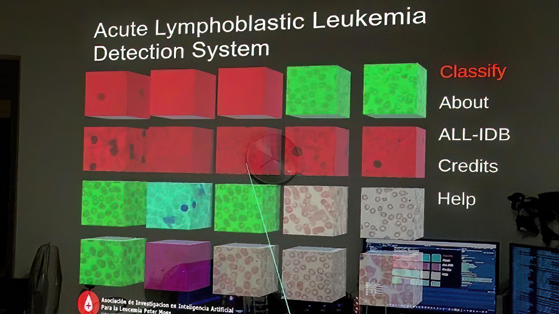 Adam Milton-Barker Detect Acute Lymphoblastic Leukemia with Magic Leap* & Intel® Technologies